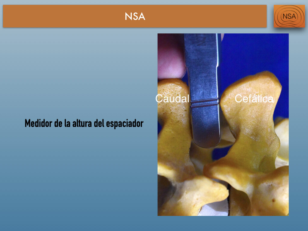 NSA Espaciador Interespinoso Omega.004.jpeg