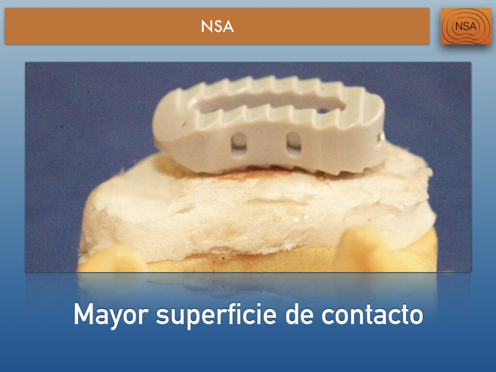 NSA Cajas lumbares.016.jpeg