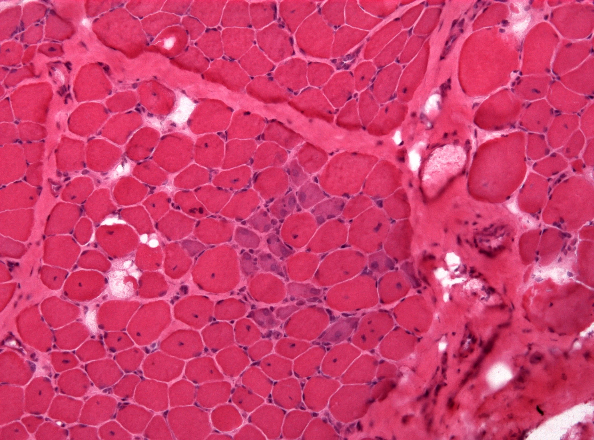 BMD_histology.jpg