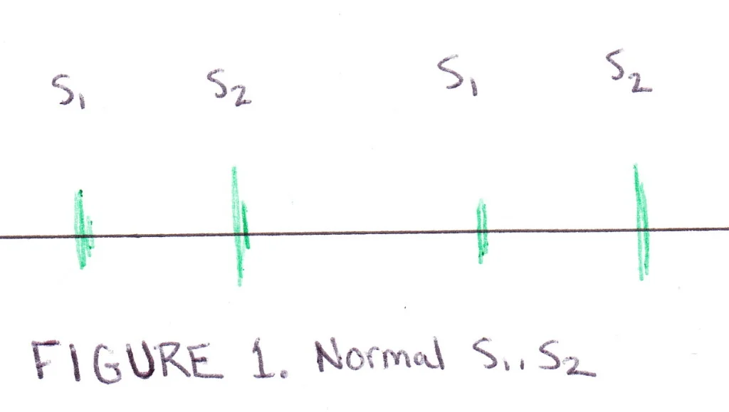 VS1-1024x579.jpg