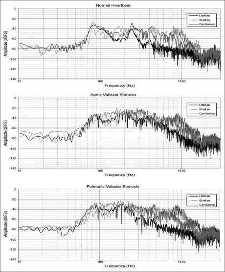 The temporal waveforms for the normal, aortic valvular stenosis and pulmonic valvular stenosis heartbeats