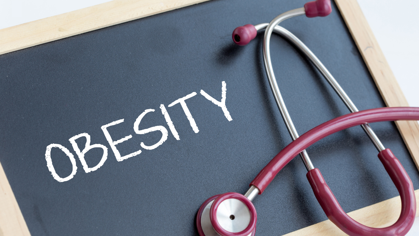 Modern Lifestyle Disorder- Obesity