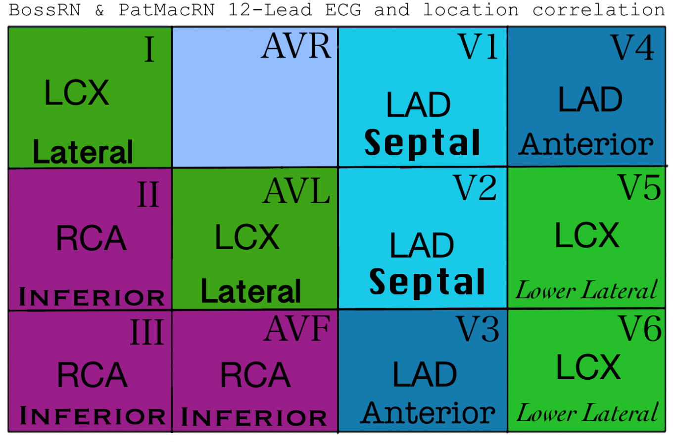 12 Lead Mi Chart