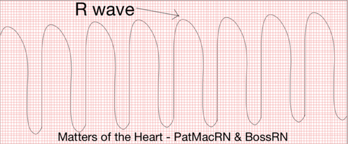 Matters Of The Heart V Tach Patmac Rn