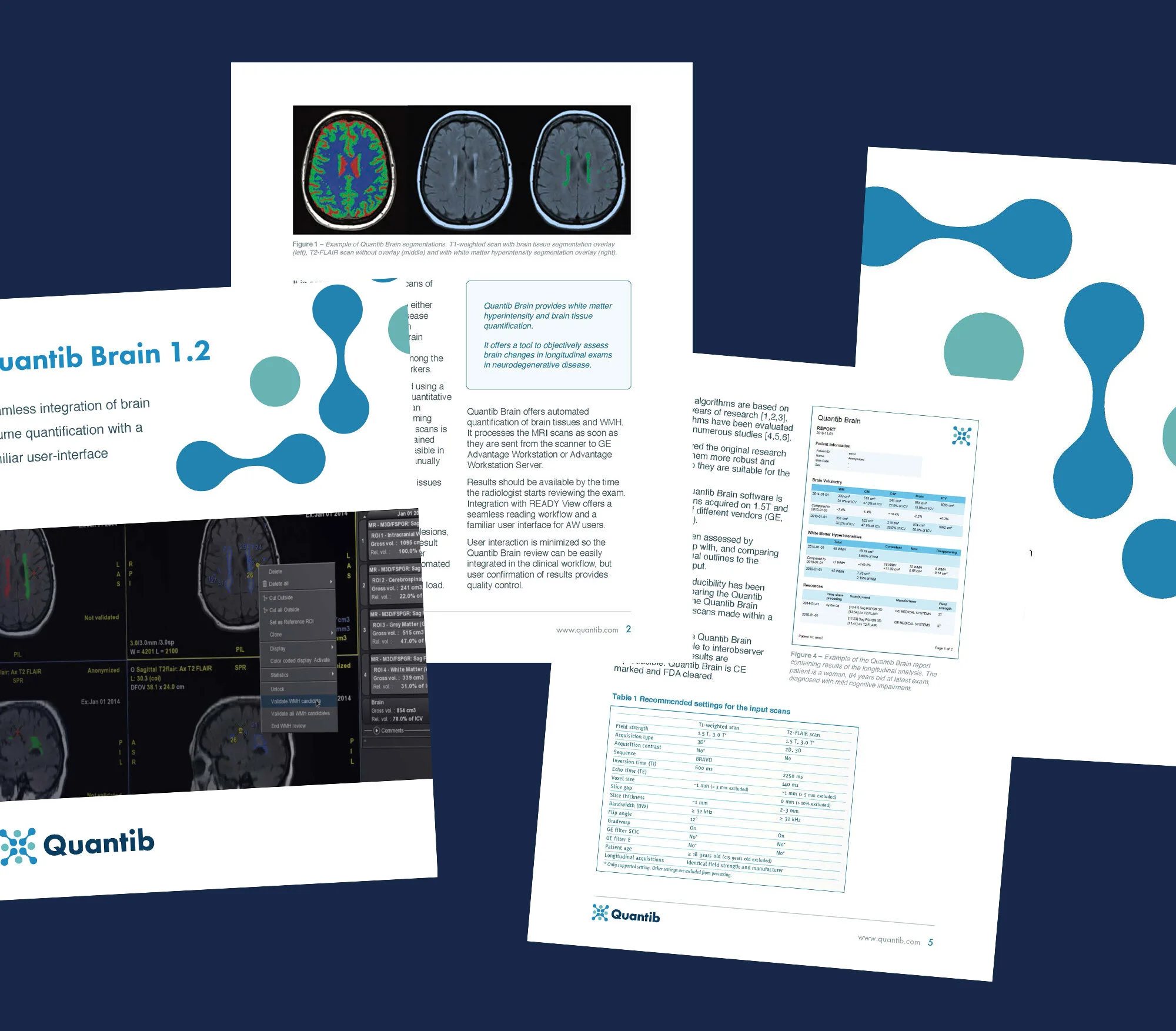 quantib-whitepaper.jpg