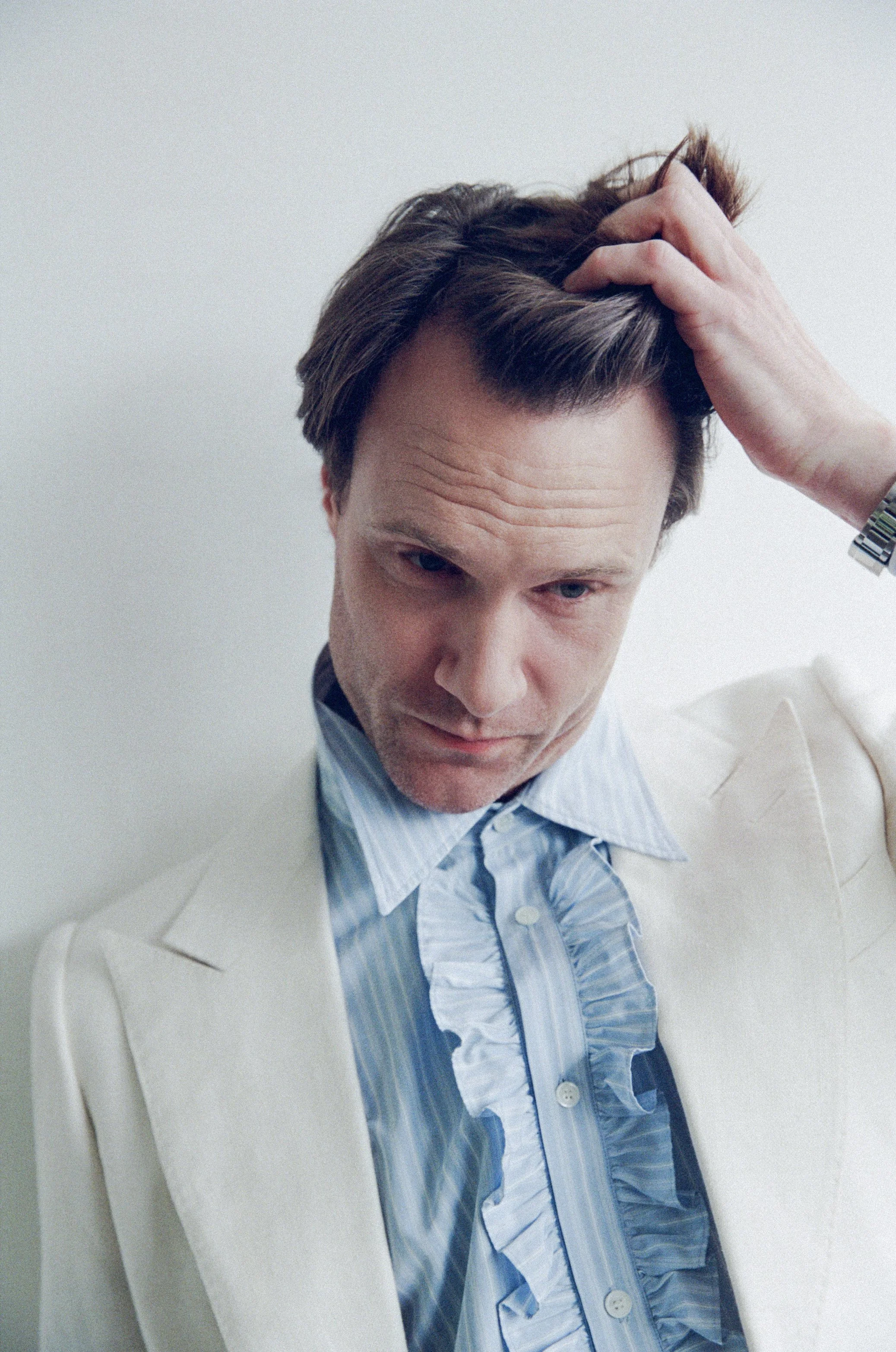 EXCLUSIVE: Hugh Skinner Prefers the Unexpected