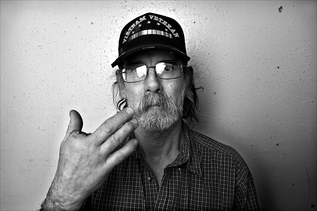 March 2017: Dennis had doctors at the VA hospital in Iowa amputate his injured finger so he could find work. “Through therapy I could have saved my finger, but at this point with it being paralyzed like it is, I’m having an issue with being able to go back to work. God said if your right eye offends you, pluck it out. Well, it didn’t offend me, but it was keeping me from being what I wanted to be — employed. I have to work until the day I die I’ll even help dig my own gave as long as y’all fill it in afterwards.”