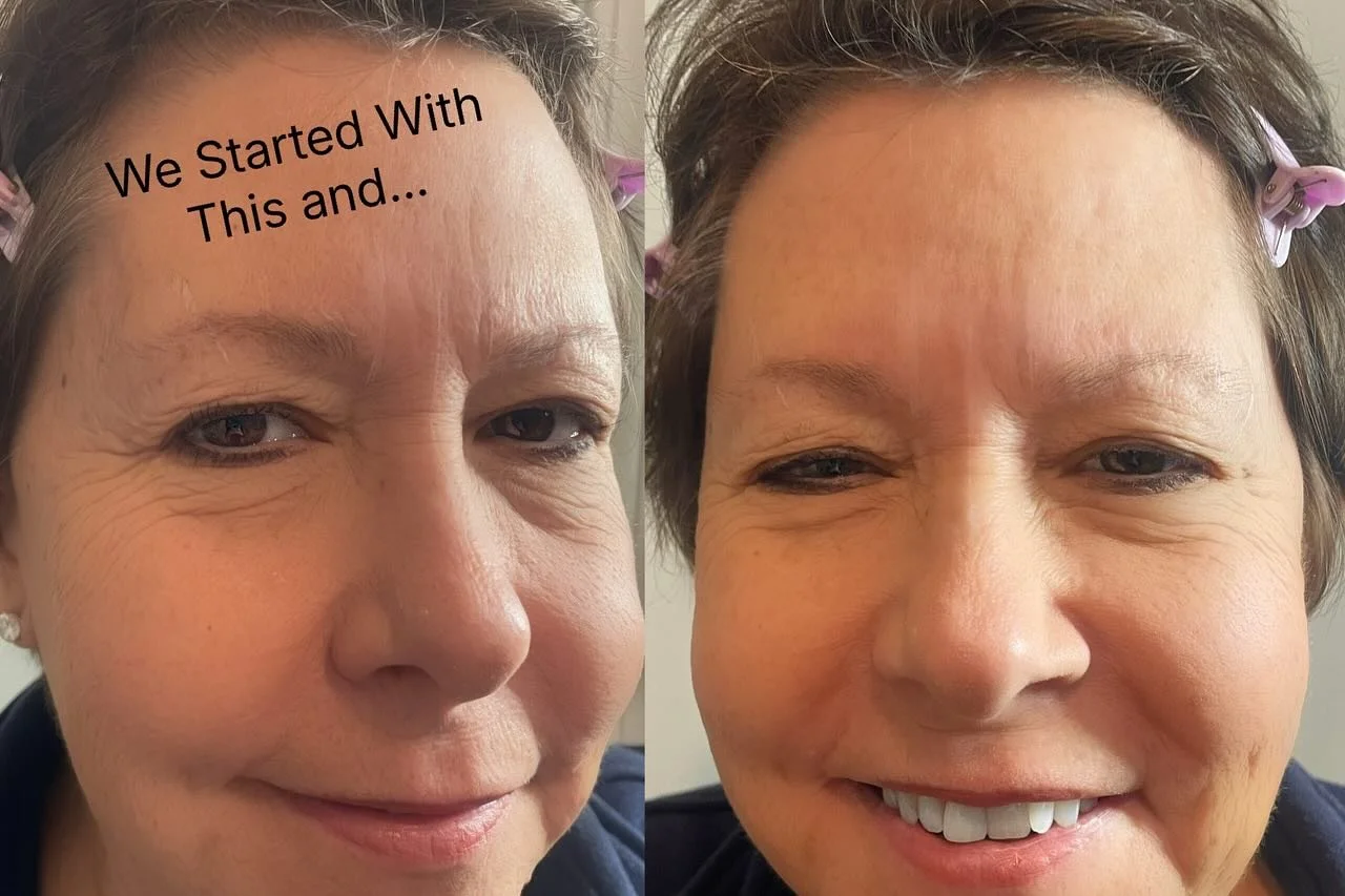 Flip thru to see the Before/After contrast! 
Fist visit for this lovely lady from St James! Our goals for this visit were to design a symmetrical, natural formed brow that suites the client best! Next visit during the complimentary touch up we will k