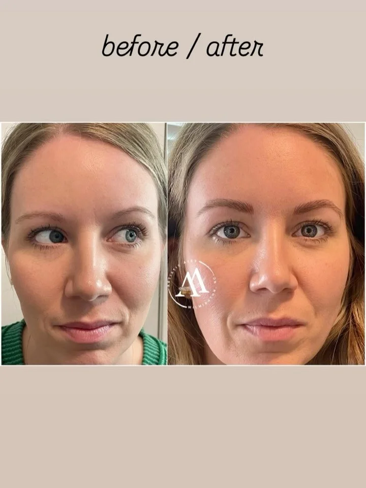 Just when you think you&rsquo;ve met &ldquo;Lovely&rdquo;~ Add a little Brow Magic &amp; meet&rdquo;Stunning&rdquo;!
.
!!No &ldquo;solid-shaped&rdquo; / &ldquo;sticker-looking&rdquo; Brows Allowed!!
#microbladingwilmington #wilmingtonmicroblading
#mi