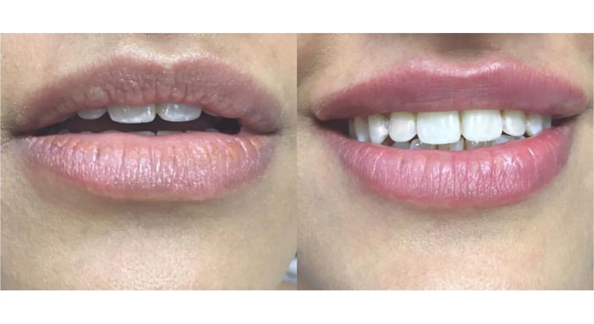 lips 1.jpg