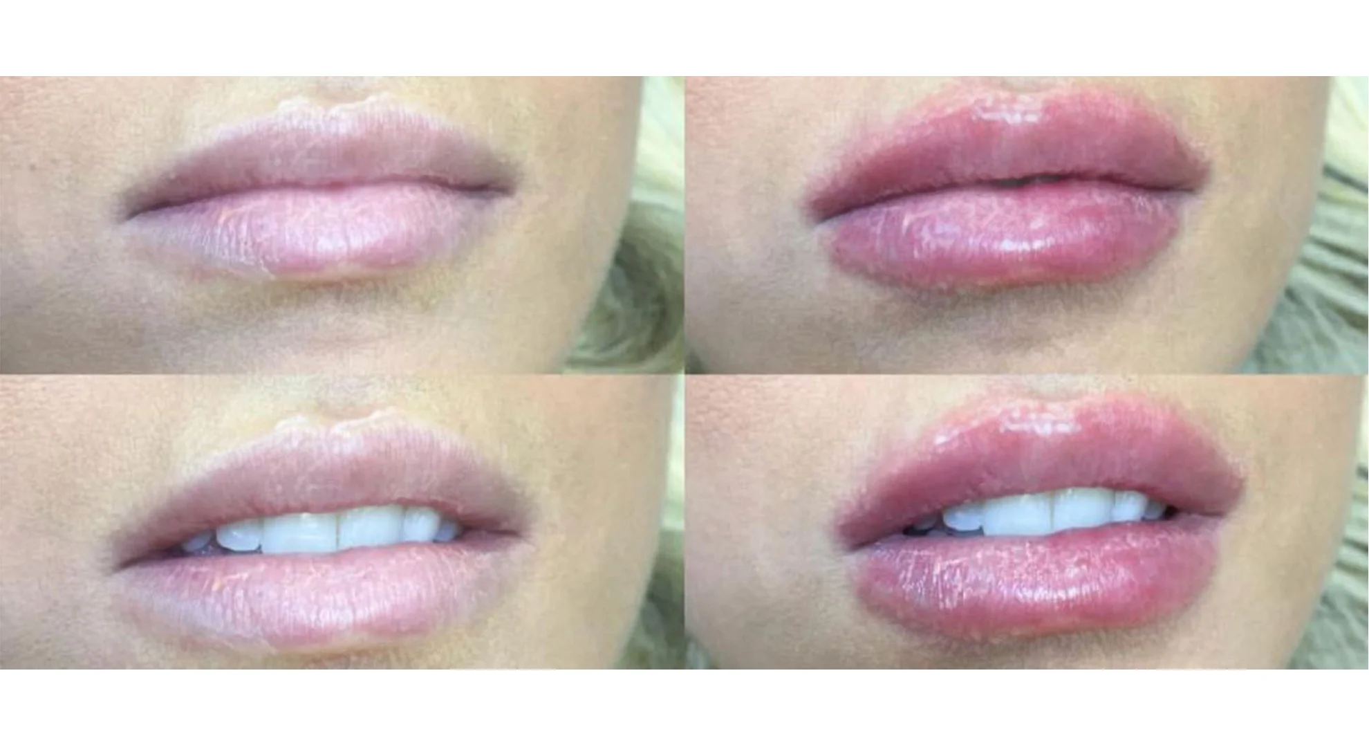 lips 2.jpg