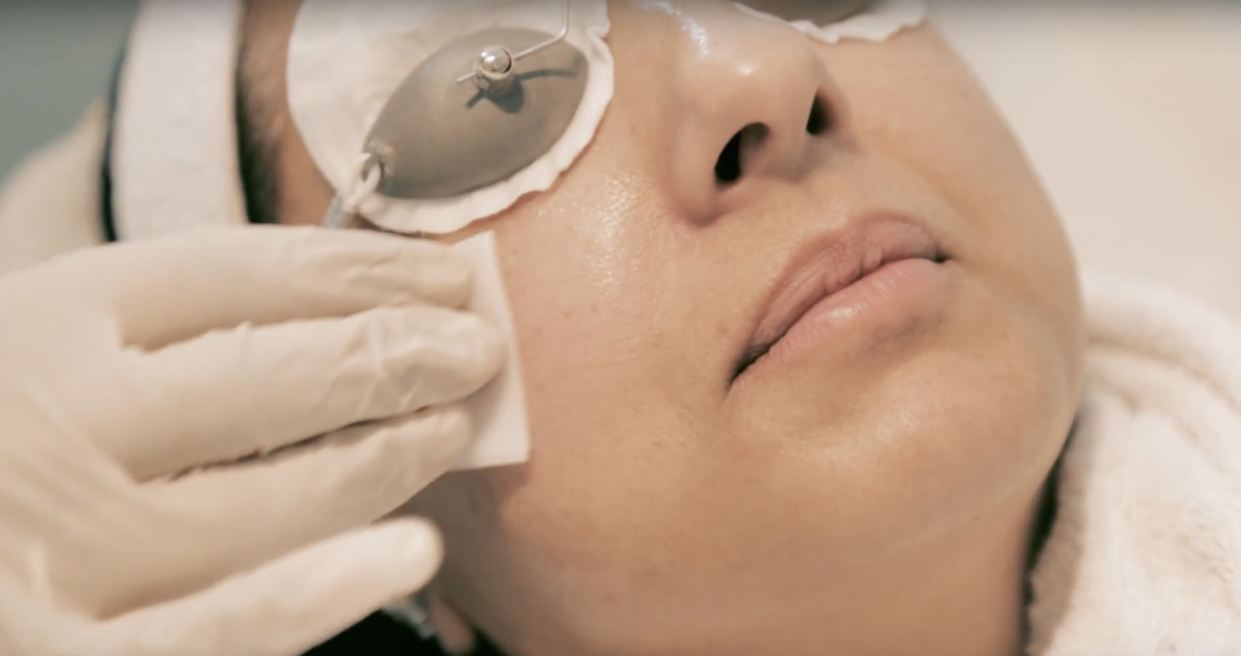 CHEMICAL MEDICAL PEEL FROM £49 PER TREATMENT