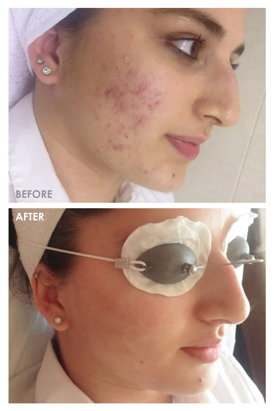 before and after - 2 copy.jpg