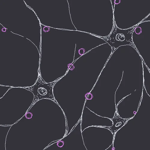 Mast Cell Activation Syndrome, meditation, and Lyme disease