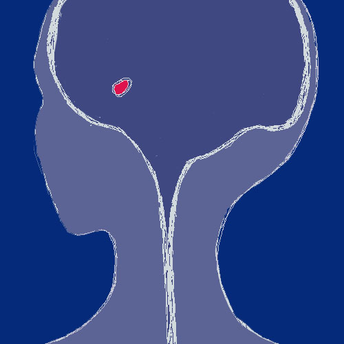 amygdala.jpg