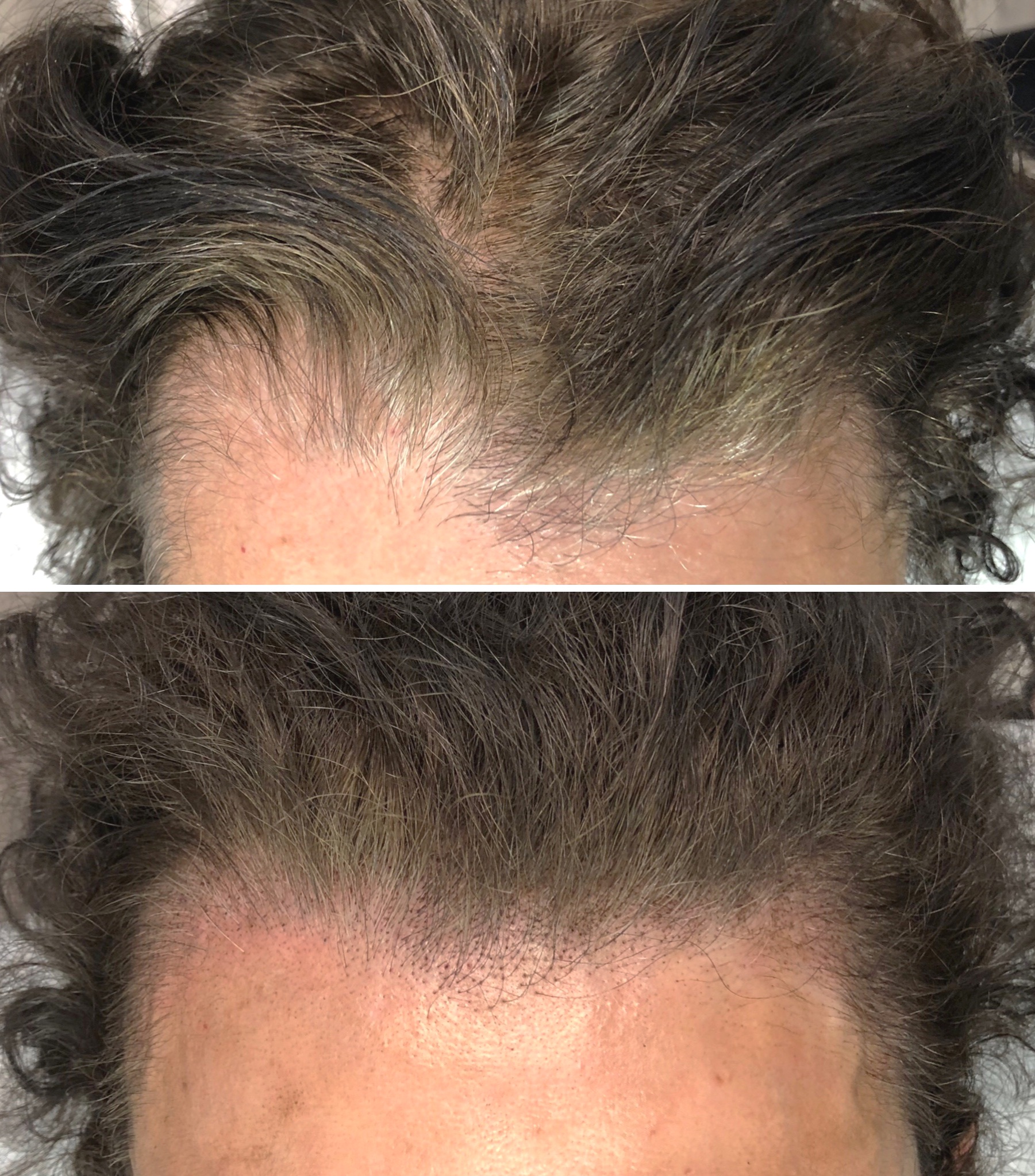 Scalp+5.jpg