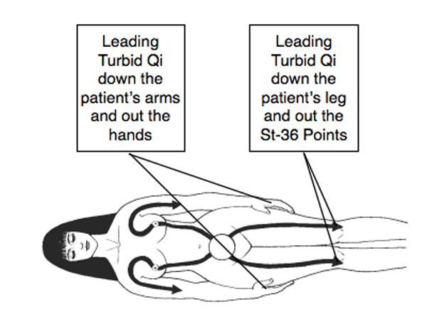 Figure 1.14. After purging the Toxic Qi from the patient’s upper body, the Qigong Doctor will continue to disperse the patient’s Toxic Qi from her lower abdomen, leading the Toxic Qi to flow down the patient’s leg and out her Stomach-36 points.