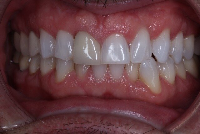 d crouch before 2.jpg