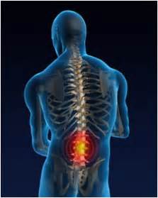 Low Back Pain.jpeg