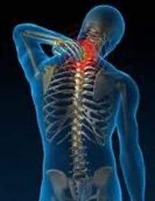 Neck Pain.jpeg