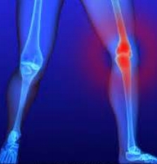 Knee.jpeg