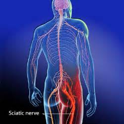 Sciatica.jpeg