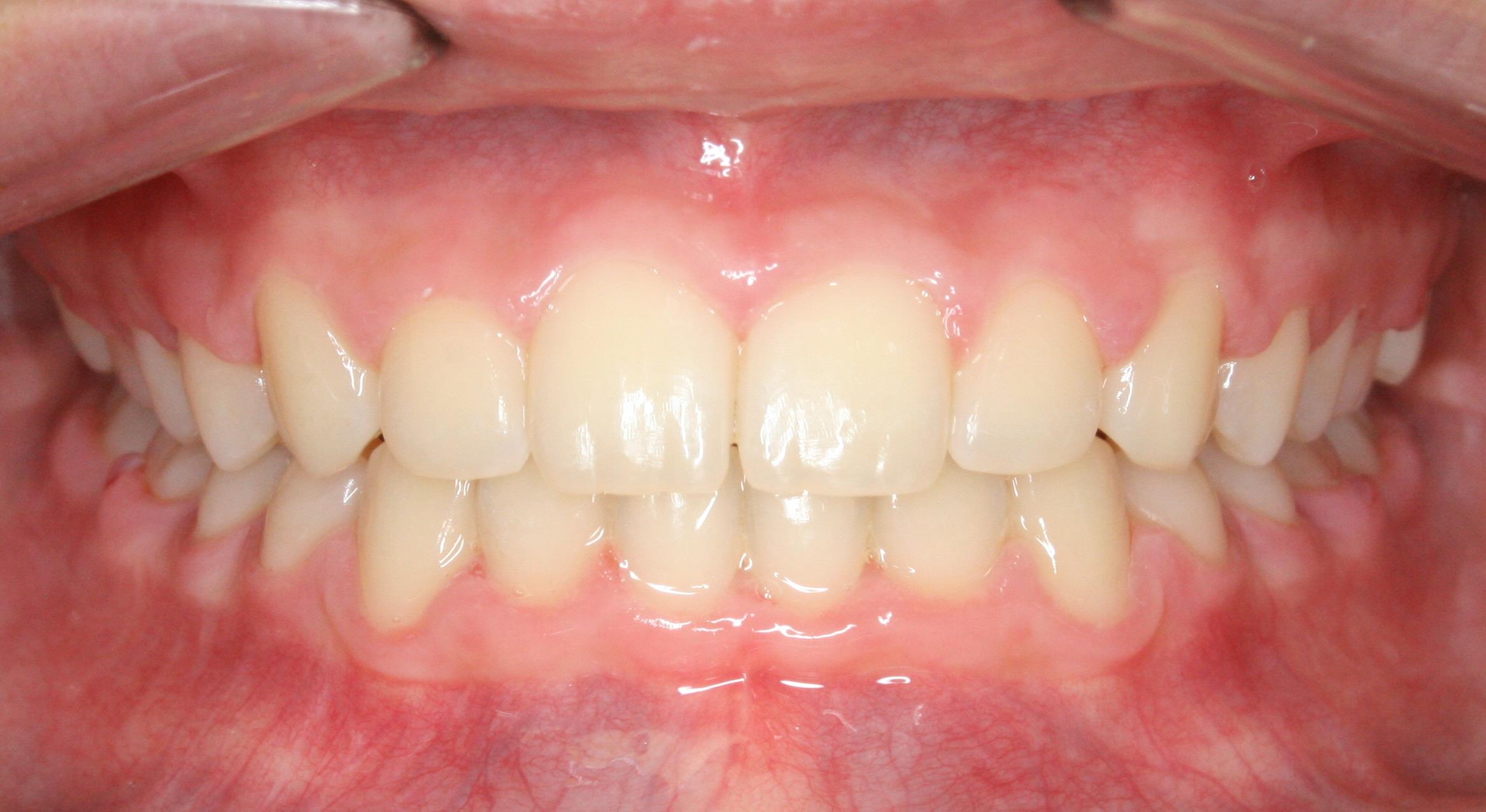 Case 3 Post - 1636762 - Madelyn Roberson - final - Intraoral Center.jpg