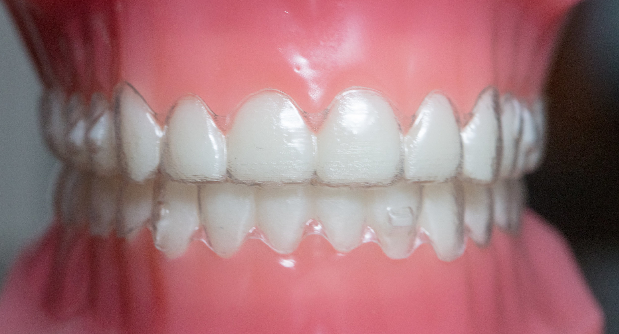 Invisalign® | Samuelson Orthodontics