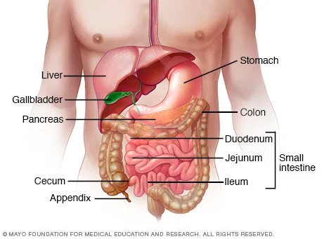 The small intestine consists of three sections: the duodenum, which is connected to the stomach, the jejuneum, and the ileum, which connects to the colon. The large intestine consists of the colon (which can be divided into ascending, transverse, descending, and sigmoid portions) and the rectum, which connects to the anus. Crohn's disease most commonly affects the ileum and the colon, although it can be present in any part of the digestive tract from the mouth to the anus. Ulcerative colitis affects only the colon and rectum. Image © 1998-2018 Mayo Foundation for Medical Education and Research (MFMER).