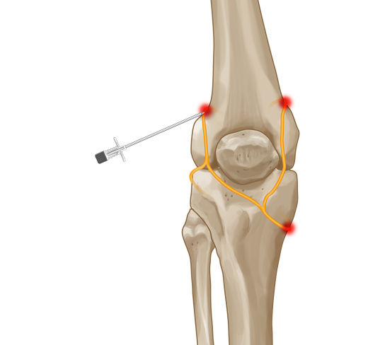 Cool_RF_knee_opt.png