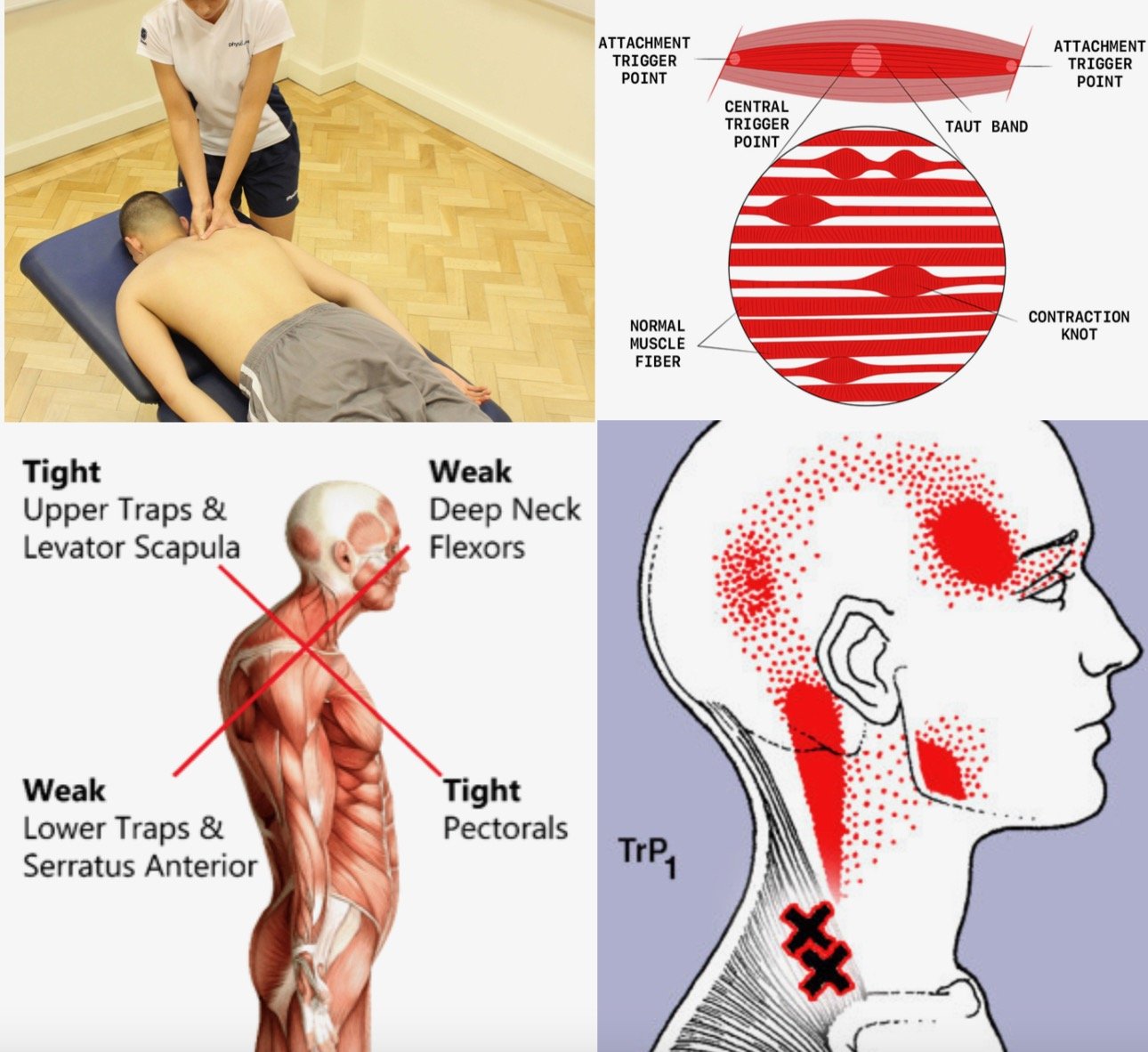 Massage Tutorial: the Trapezius (deep tissue, anatomy review) 