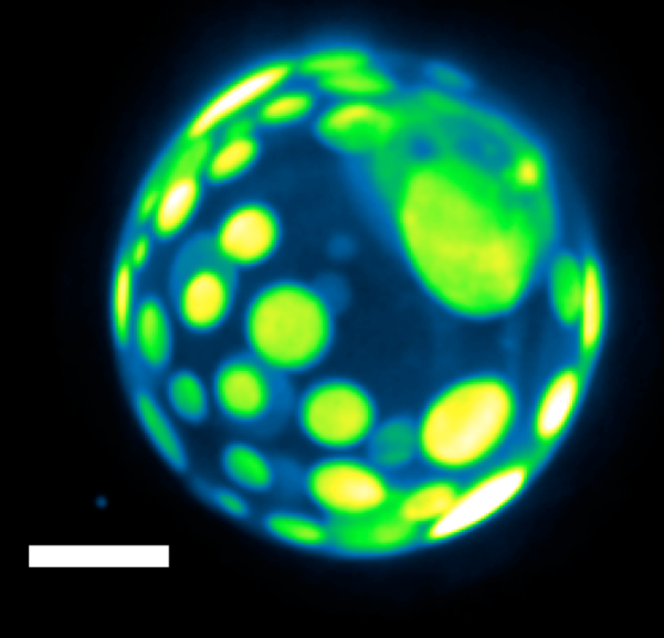 Protein-Lipid Interactions