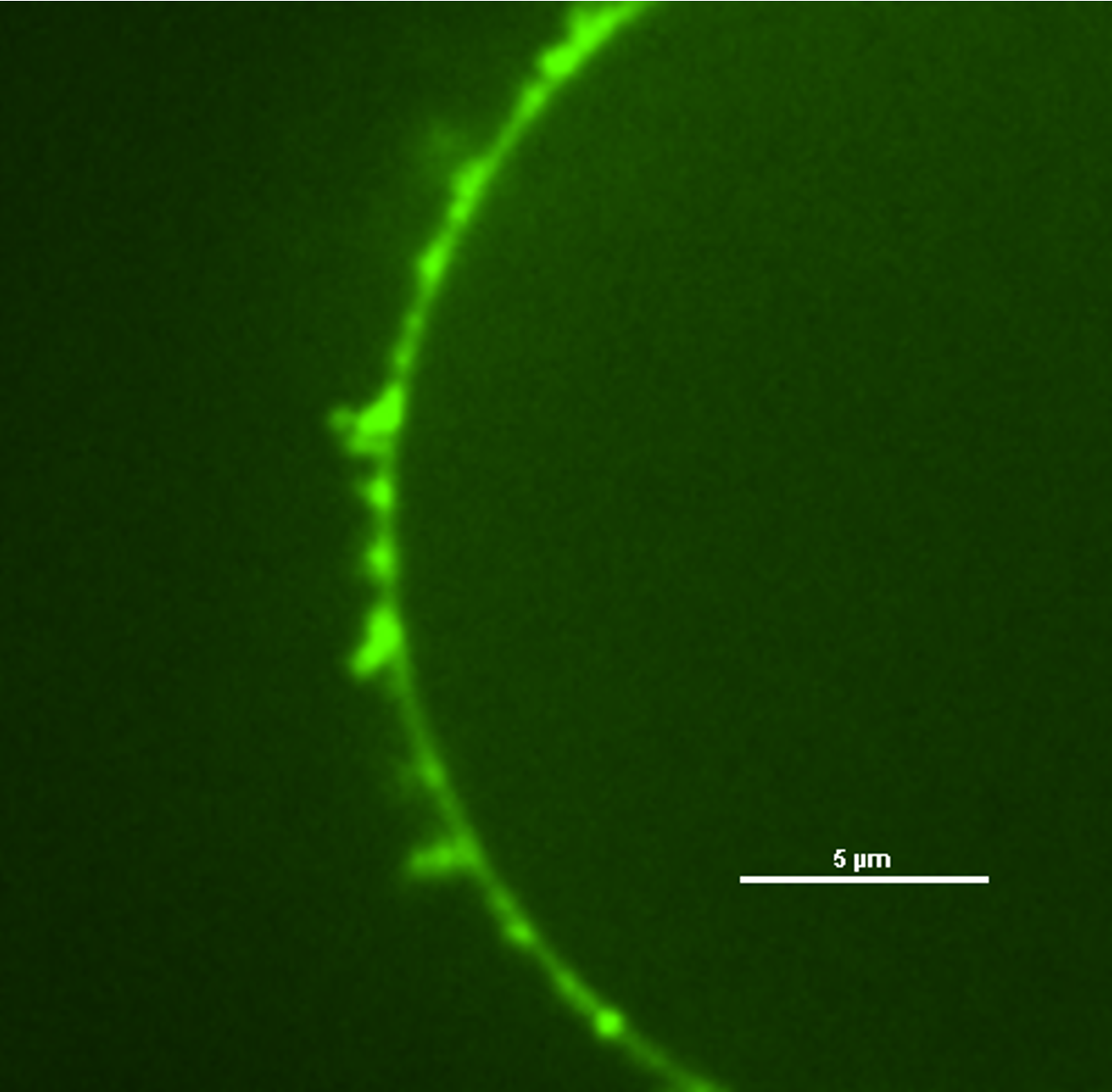 A model cell membrane associating with polystyrene nanoparticles. As the particle bind to the lipid molecules in the membrane, they form aggregates that pull the membrane into dendridic protrusions.