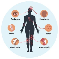 THE ZIKA VIRUS:  PANIC??