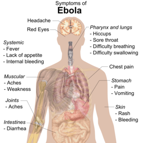 WHAT IS EBOLA? SHOULD I BE SCARED?﻿