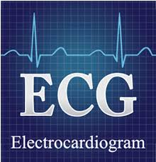 ECG.jpeg