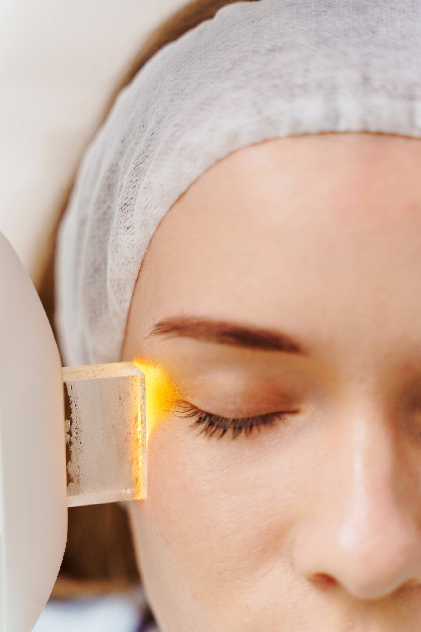 The Best Pigmentation Treatments in Singapore for Even Skin Tone