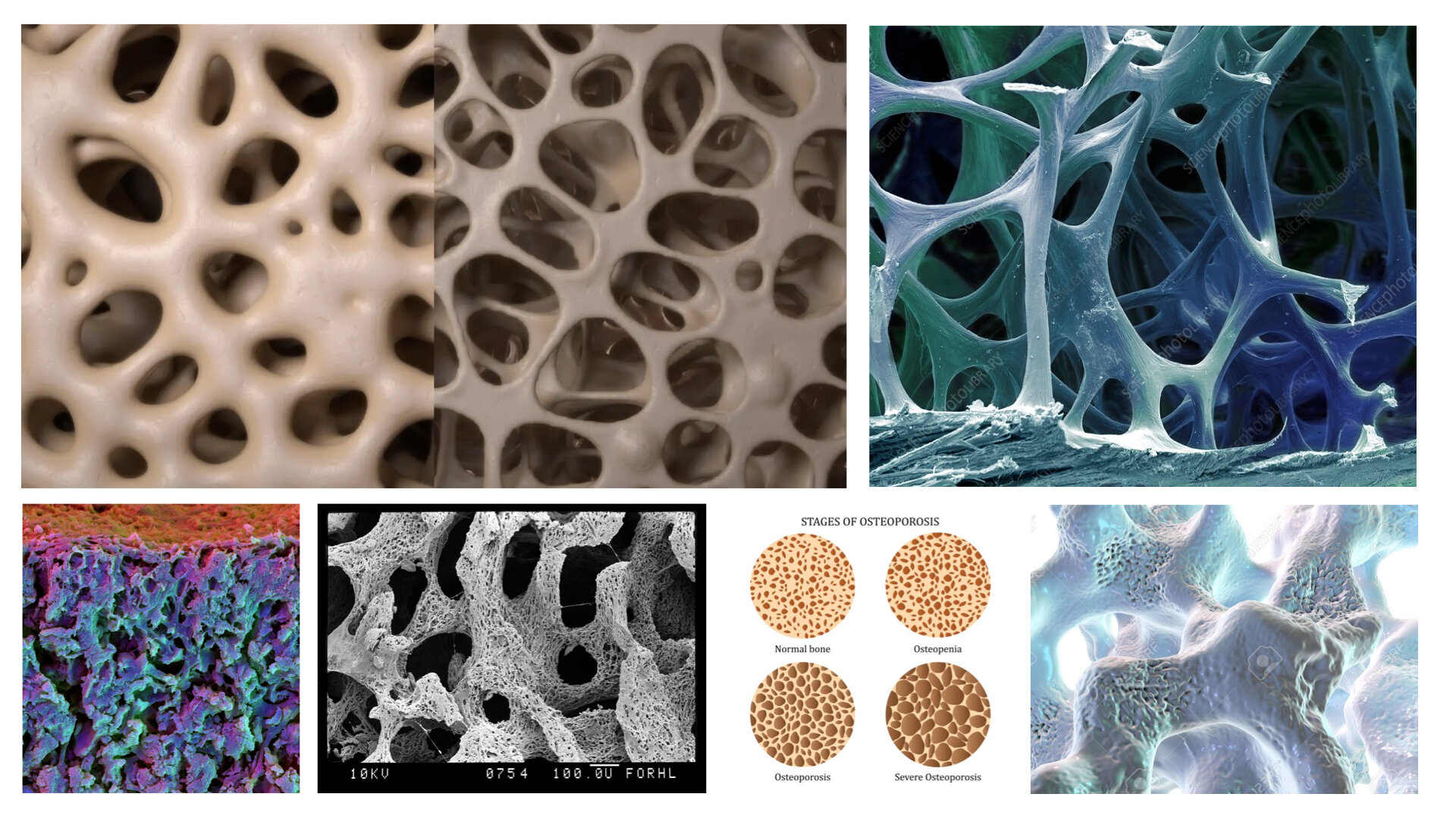 Research Bone.002.jpeg