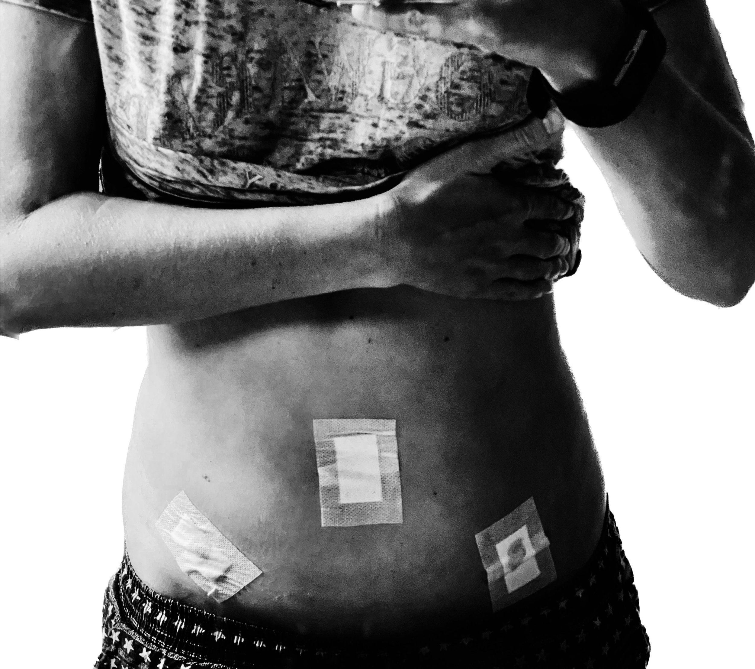 Scars are proof the past was real