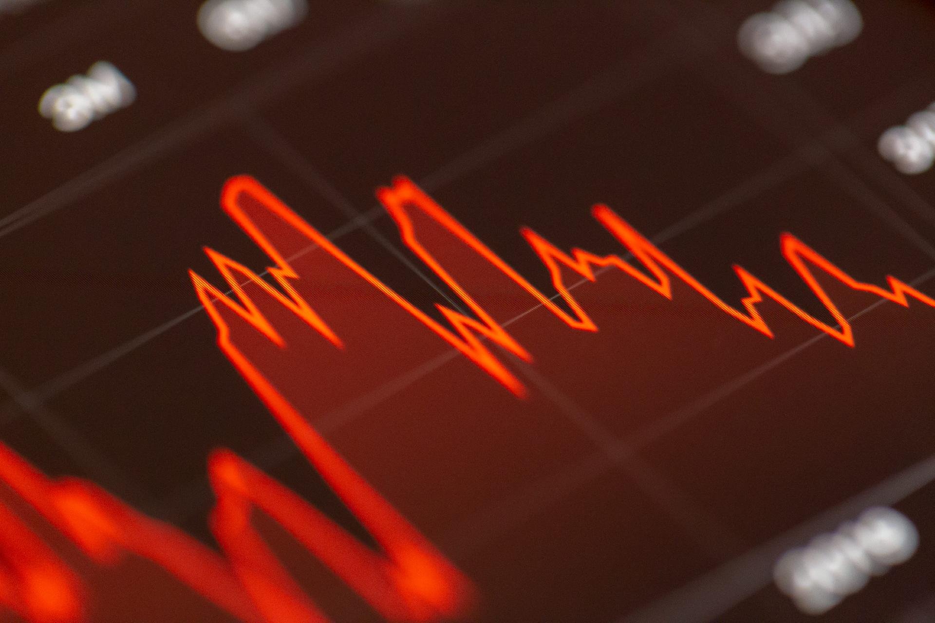 The NEW FED Rate Transformation Brought Out The OLD Wall Street Playbook