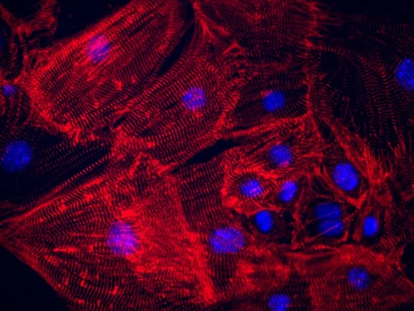 Heart cells. Photo courtesy of Haixa Wang/Gladstone Institutes