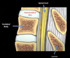 Discectomy — Spine Together