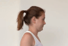 Physical Therapy After Cervical Laminectomy or Discectomy — Spine Together