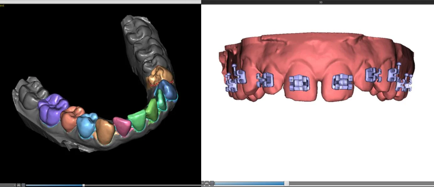 BlueSkyPlan Ortho — Baron Grutter DDS