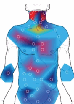 What is Thermometry?