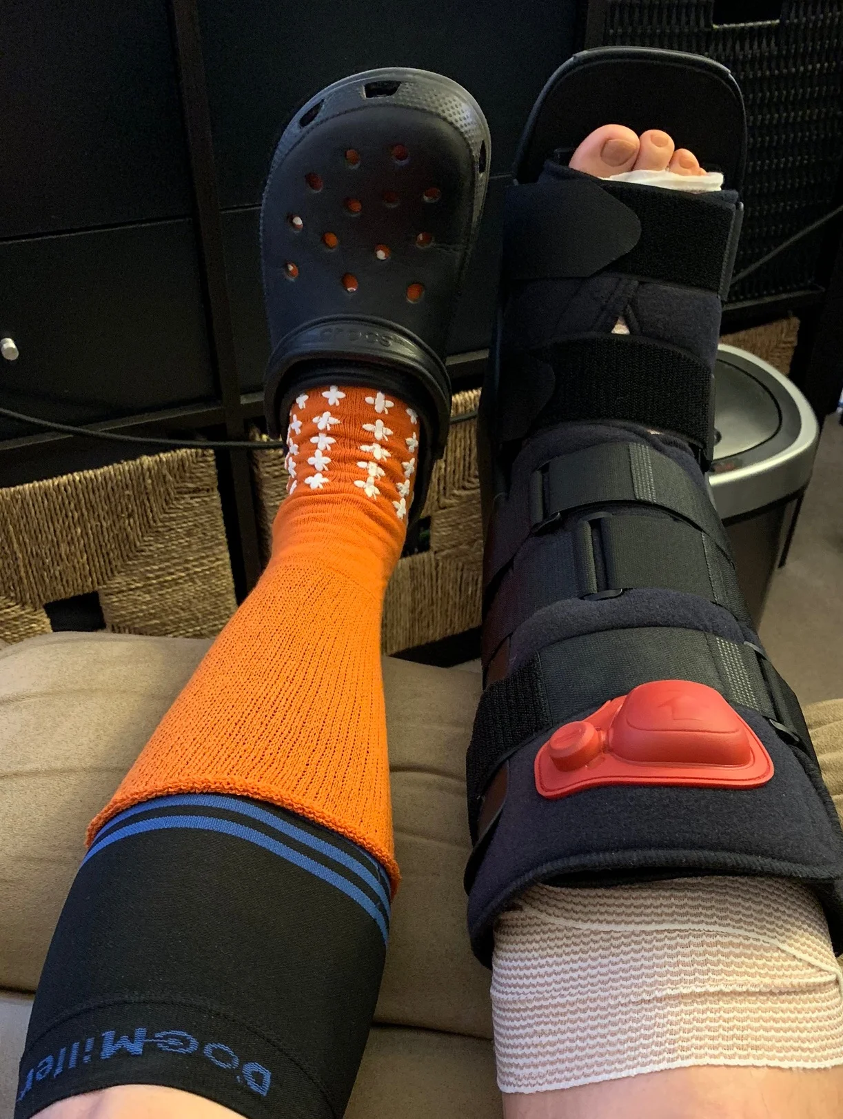 Haglund's Surgery Week 1 — Craig Edward Given