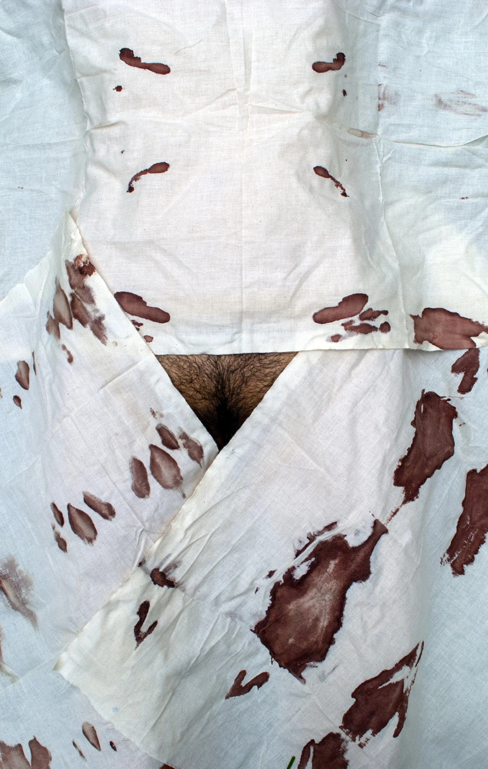 ‘Beauty and the Blood’