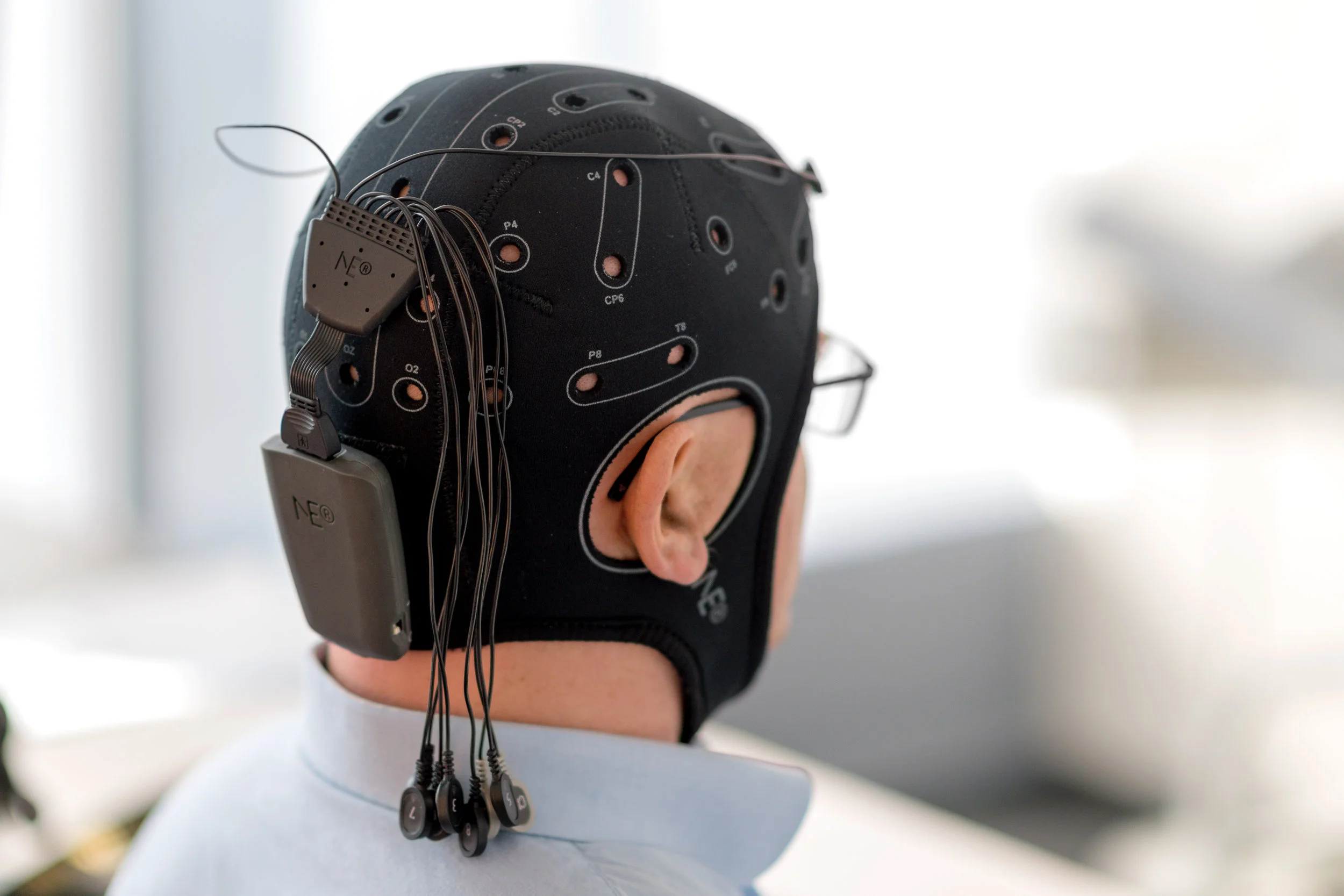 tDCS.jpg