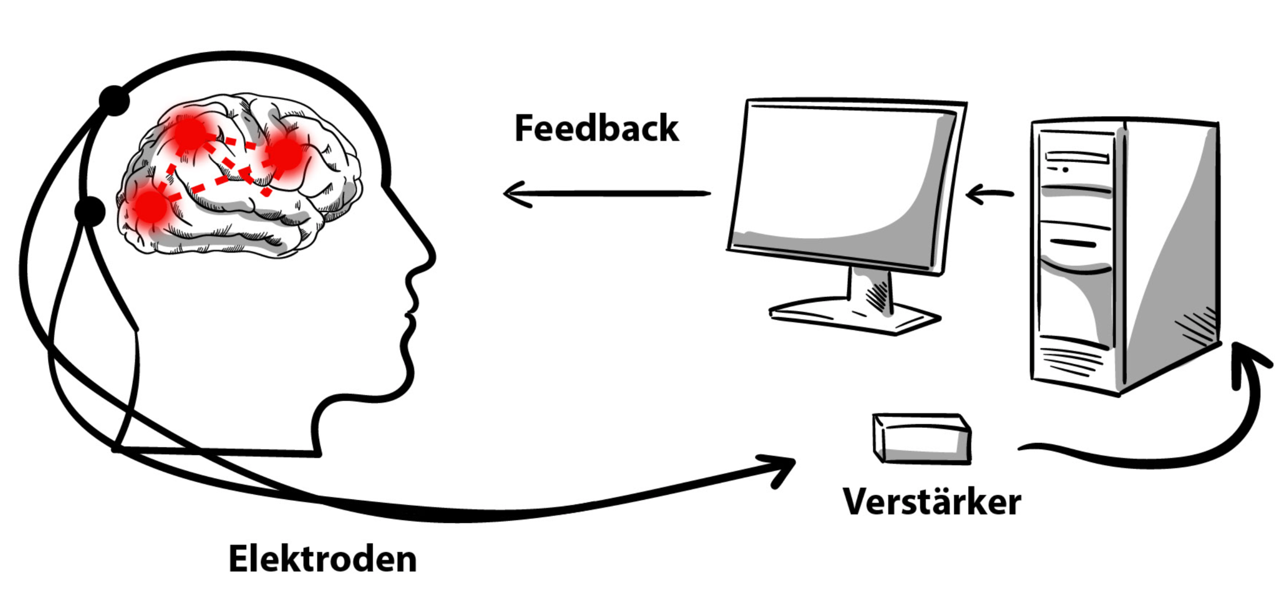 Erklärungsvideo Neurofeedback