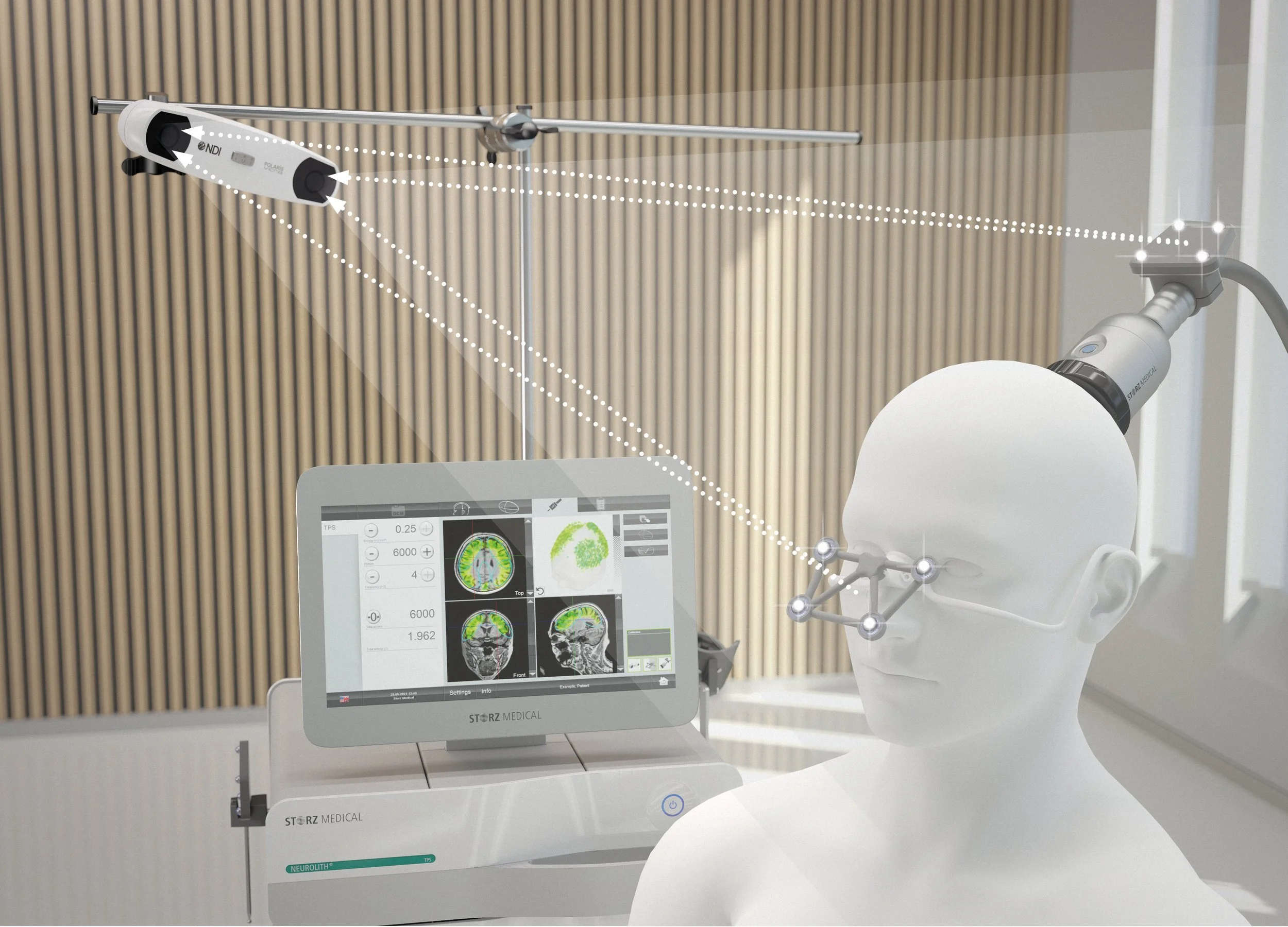 Transkranielle Pulsstimulation (TPS) zur Behandlung der Alzheimer-Demenz
